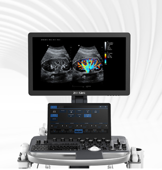 中旗彩色多普勒超声系统M70代理