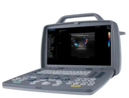 全数字彩色多普勒超声诊断系统Apogee 5S直销价