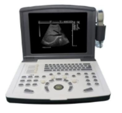 刊智便携式全数字彩色超声诊断仪KZ-02询价