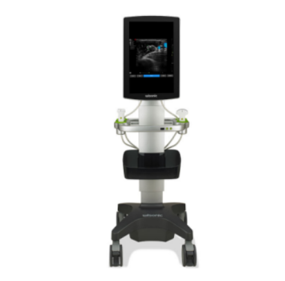 华声彩色超声诊断系统Navi u代理