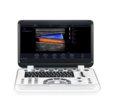 聚融便携式彩色多普勒超声诊断系统Finus 80Sic代理