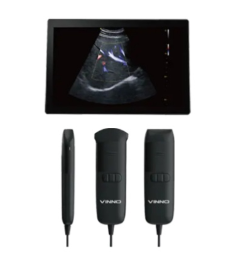 飞依诺掌上彩色超声诊断仪VINNO Q5E＋3C询价