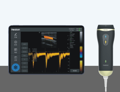 汇声微型彩色超声诊断系统C30L代理