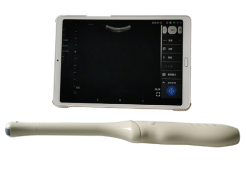 索诺康腔内无线掌上彩色多普勒超声显像仪P5E询价