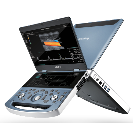 迈瑞便携式彩色多普勒超声系统MX7 Pro询价