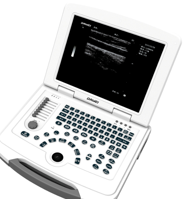 大为笔记本全数字超声诊断仪DW-580直销价