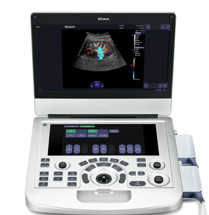 理邦便携式全数字彩色超声诊断系统Acclarix AX9 Basic厂家