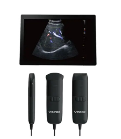 飞依诺掌上彩色超声诊断仪VINNO Q3E＋2P询价