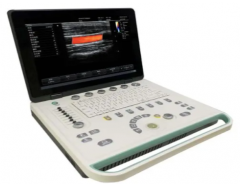 和赛仑掌上彩色多普勒超声诊断仪300L询价