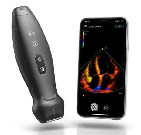 微影无线掌上彩色超声诊断仪SENZ310A供应商