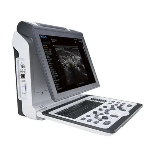 百科彩色多普勒超声诊断仪2300代理