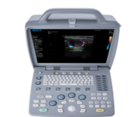 全数字彩色多普勒超声诊断系统Apogee U3供应商