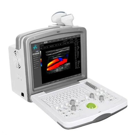 威尔德彩色多普勒超声系统Z6询价