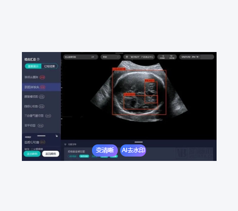 爱孕记产前动态超声影像处理系统AiriScan S10厂家