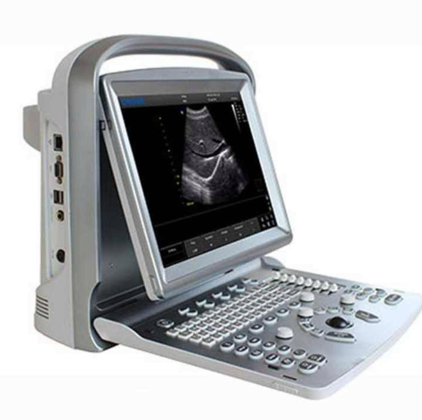 大为全数字笔记本式超声诊断仪DW-690代理