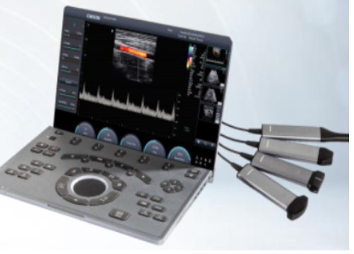 全数字彩色超声诊断系统SonoMax 55采购价