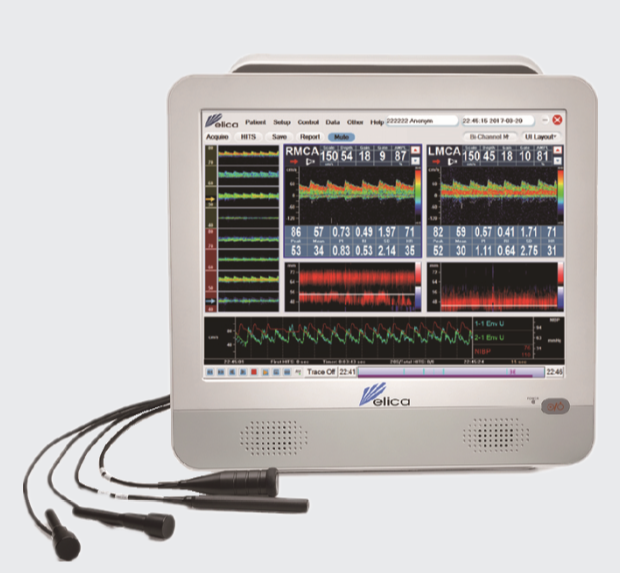 德力凯超声经颅多普勒血流分析仪EMS-9D EXP询价
