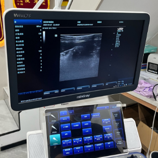 精康肝脏超声影像管理软件PM_LC询价